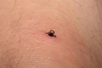 Erkės jau pabudo: gydytoja įspėja apie pavojingą ligą, galinčią sukelti paralyžių