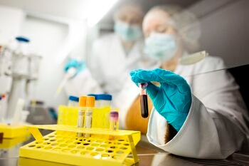 Vieni metai sveikesnės Lietuvos link: Lietuvos populiacijos ir retųjų ligų biobankas pristatys pirmuosius rezultatus