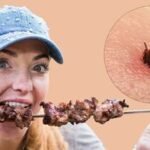 Erkės platina ne tik infekcijas - sukelia pavojingą gyvybei alergiją mėsai (Atnaujinta)