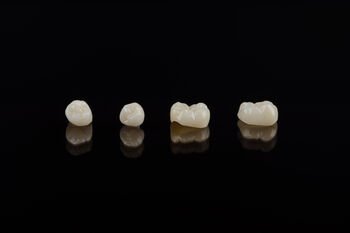 Dantų vainikėlių medžiagos ir jų skirtumai: ką svarbu žinoti?