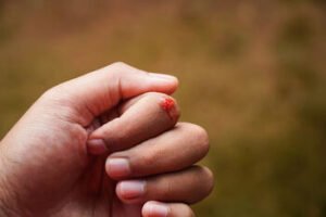 ​​Maža žaizda – didelė rizika: kodėl stabligė vis dar pavojinga ir kada būtina skubėti pas gydytoją?