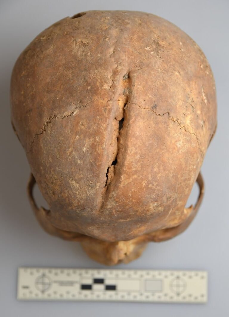 Įgyvendintas didelis bioarcheologinis tyrimas Lietuvoje: mokslininkai atkūrė senovės vilniečių gyvenimo istorijas