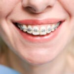 Kur tiesinti dantis Vilniuje? 7 klinikos, kurias verta apsvarstyti