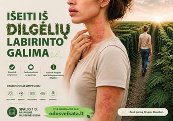 Dilgėlinės diagnostikos labirinte: kodėl kaltininko ieškome ne ten?